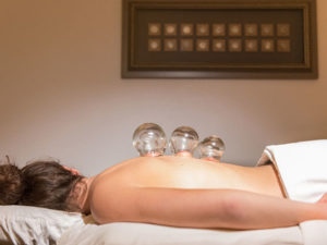 Cupping treatment from Corvallis Acupuncture & Wellness Center in Corvallis, Oregon